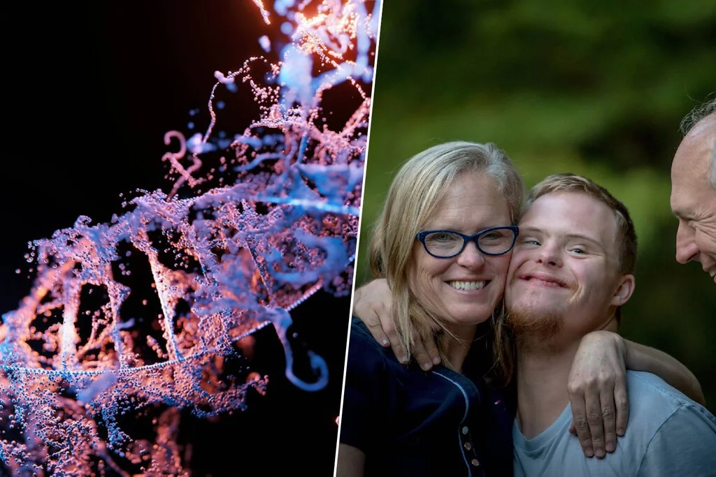 El apagado del cromosoma extra del síndrome de Down plantea dilemas éticos en la ciencia