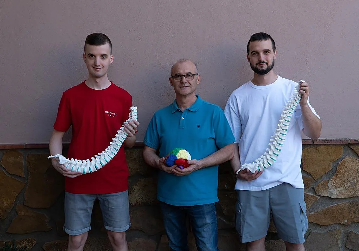 La innovación granadina en impresión 3D revoluciona tratamientos médicos personalizados